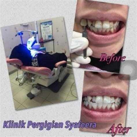 Dental clinic in taman connaught, cheras. Klinik Pergigian Syafeera, Klinik Pergigian in Cheras