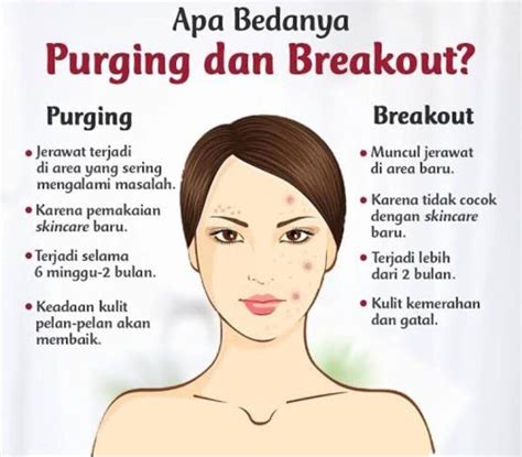 Ciri Ciri Purging Pada Wajah Setelah Menggunakan Skincare Riset