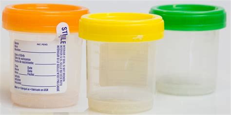 Parter Medical Products Sterile Specimen Cupsclinical Specimen