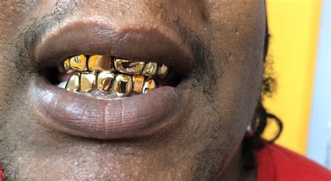 18k Gold Grillz Smirkgoldgrillz