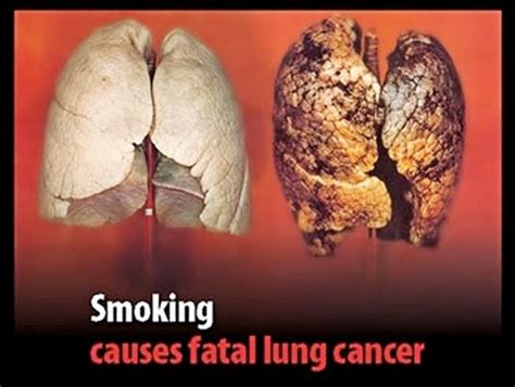 It brings substances into the body that damage cells lining the lungs. The Sunshine State Is not for Big Tobacco