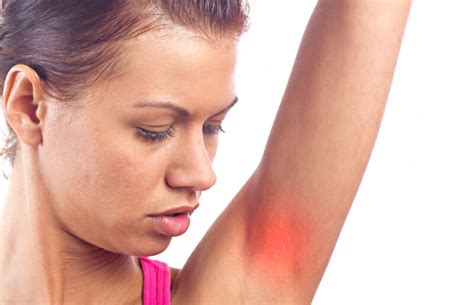 Underarm Rash Causes Pictures Painful Red Itchy Rash Treatment