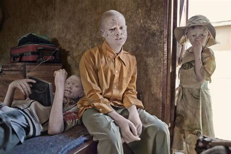 La maldición de los albinos en Tanzania Lifestyle EL MUNDO