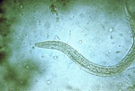 Hookworm Vaccine Trials Begin At Gw Gw Today The George Washington