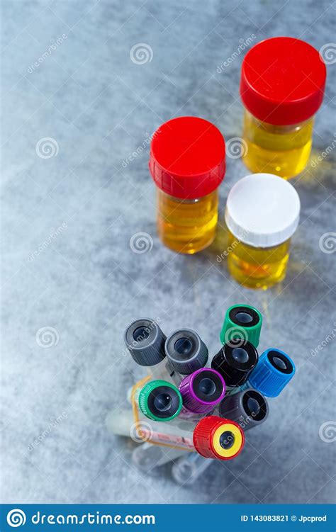 Research Concept Colorful Laboratory Test Tubes Blood Tests Urine