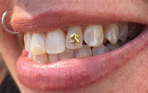 Pin By Westminster Tattoo Company On Tooth Gems Tooth Gem Teeth