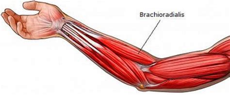 Brachioradialis Pain And Treatment