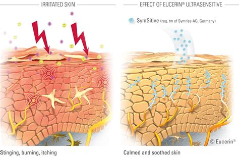 Eucerin Hypersensitive Skin Ultrasensitive Soothing Care Dry Skin