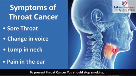 Throat Cancer Causes Symptoms Prevention And Treatment Dr Arun Kumar Giri Youtube