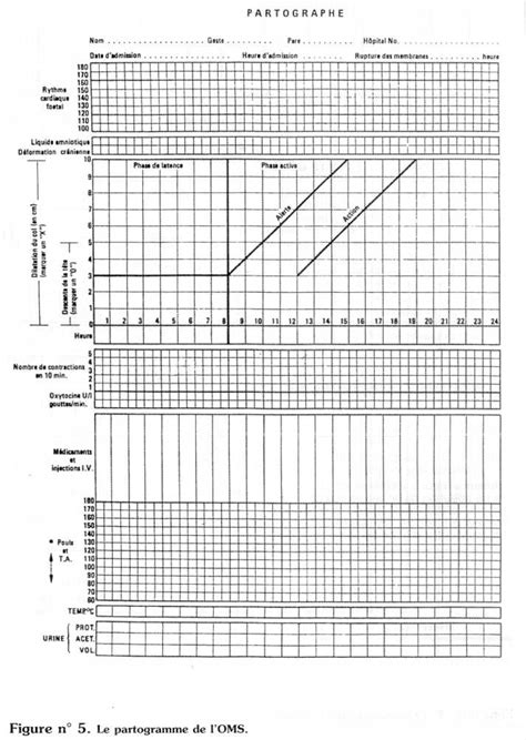 Program, a part of planning. Développement et Santé | Le partogramme : principes et ...