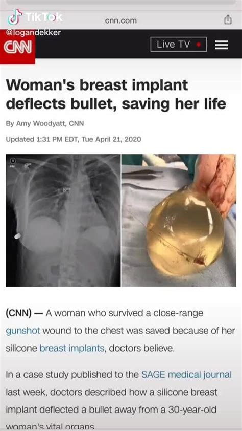 TikTok Can Com Woman S Breast Implant Deflects Bullet Saving Her Life