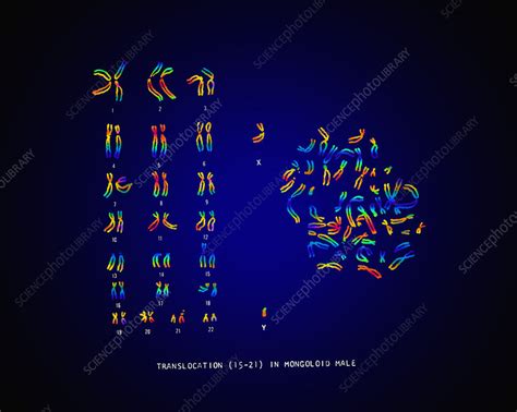 male karyotype showing down s syndrome stock image c022 0565 science photo library