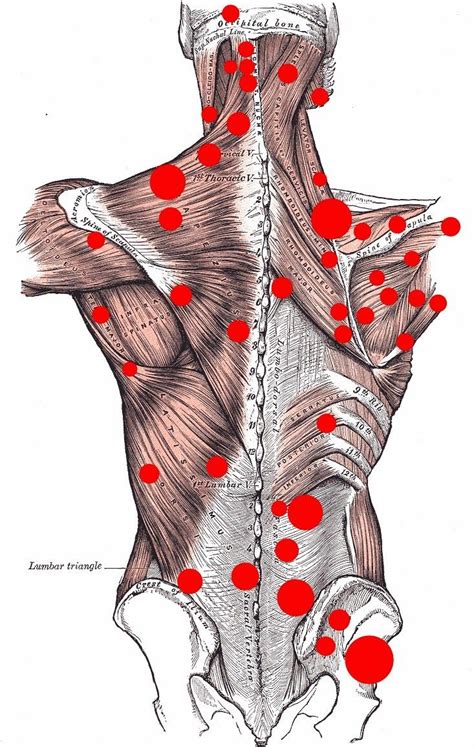 Santa Barbara Massage Blog What Is A Trigger Point Trigger Points Muscle Knots Trigger
