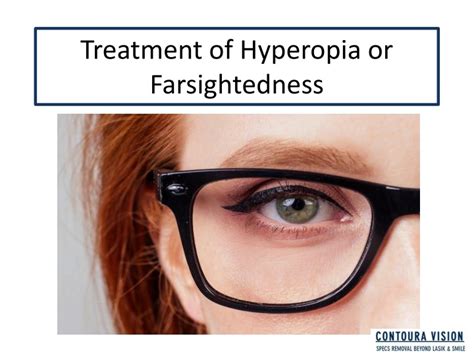 Ppt Treatment Of Hyperopia Or Farsightedness Powerpoint Presentation