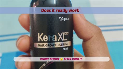 Great news!!!you're in the right place for hair regrowth serum. KeraXL serum review/ Hair regrowth - YouTube