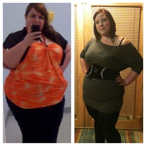 Gastric Bypass Weight Loss Before And After Pictures Before And After