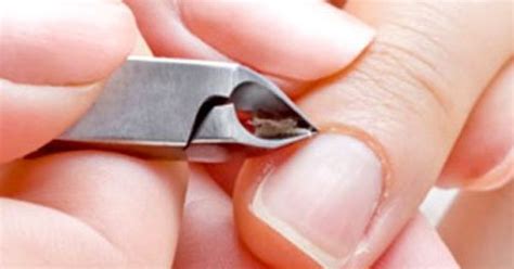 The type treatment to be applied will also depend on the age, medical history of a patient as well as the severity of the resultant symptoms. Dry Peeling Cuticles - Home Treatments. Read more...http ...