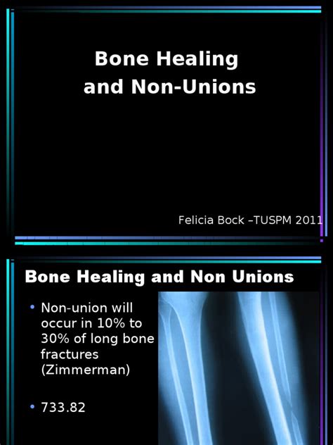 Bone Healing And Non Unions 1 Bone Skeletal System