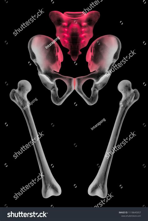 Xray Separate Human Hip Femur Bone Stock Illustration 1118645057