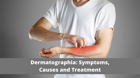Dermatographia Symptoms Causes And Ayurvedic Treatment Vims