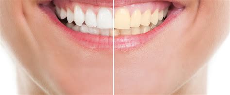 The Benefits of Cosmetic Dentistry: A Comprehensive Guide