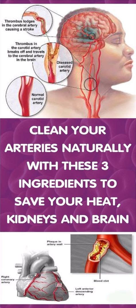 how to clean out plaque in arteries 3 ingredients mixture health clean arteries health