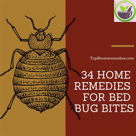 34 Home Remedies For Bed Bug Bites Home Remedies For All Kinds Of