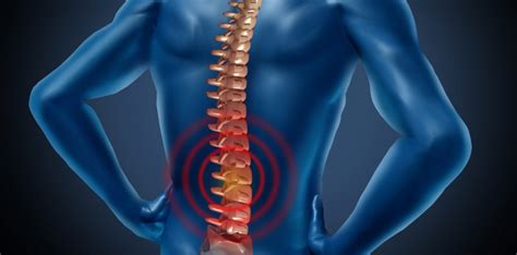 Chronic Back Pain Causes Marietta Pain Doctor Pain Management Atlanta
