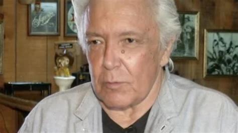 Alberto Vázquez Cancela Shows Por Parálisis Facial
