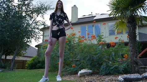 Embrace Differences Teen Secures Record For Worlds Longest Female