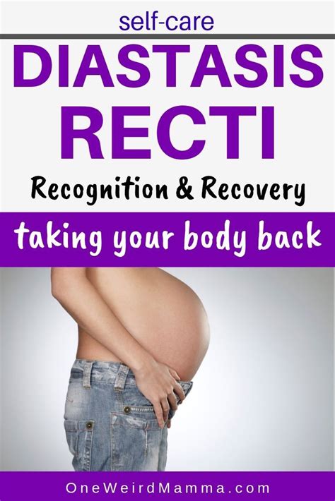 Diastasis Recti Artofit