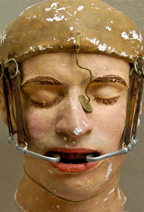 Splint Apparatus World War I Facial Reconstruction Model Guerre