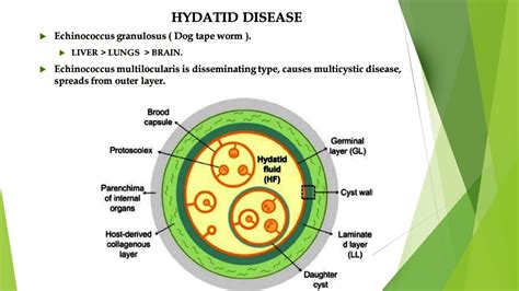 Hydatid Cyst Liver Part A Structure Life Cycle Iwge Grading