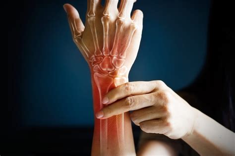 Whats Causing My Wrist Pain Spine Center Of Texasspine Center Of Texas