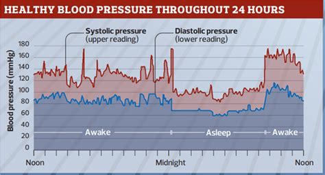 Blood Pressure Fluctuations During The Day Chart Chart Examples