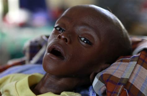 Pneumonia And Diarrhoea Responsible For 14 Million Child Deaths Each