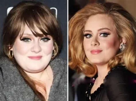 The Most Expensive Celebrity Plastic Surgeries Ever And How Much They Cost Celebrity Plastic