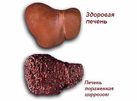 Диета с печенью больной