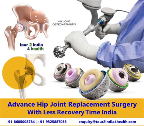 Advanced Hip Replacement Surgery In India At Low Cost Hip Replacement