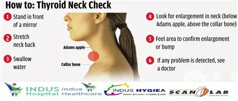 How To Thyroid Neck Check Thyroid Neck Thyroid Surgery Thyroid