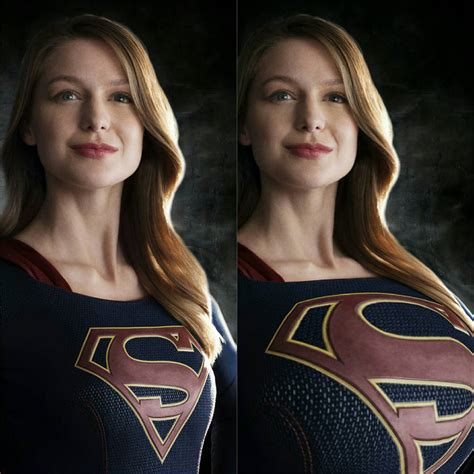 Supergirl Breast Expansion Telegraph