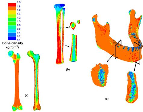 Bone Density Distribution Predicted Using The Bone Remodelling Model