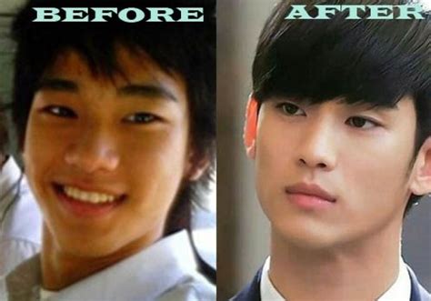 Won bin plastic surgery adds to the list of korean celebrities who get plastic surgery to improve their appearance and it is possible to boost their confidence as well. Kim Soo Hyun No Makeup - Korean Idol