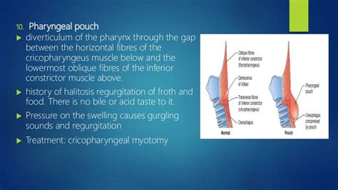 An Approach To The Neck Mass