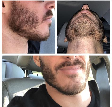 How To Trim A Stubble Beard Neckline To Perfection Artofit