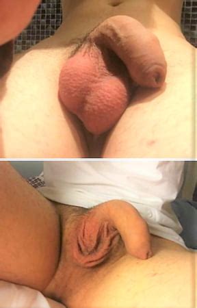 Male Castration Pics Xhamster
