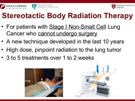 Radiation Therapy Procedure For Lung Cancer All About Radiation