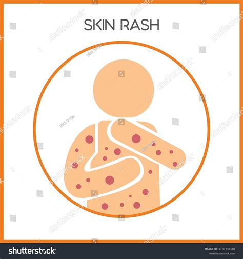 Skin Rashes Vector Icon Skin Disease Royalty Free Stock Vector