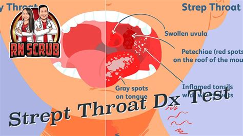 Strep Throat Streptococcal Pharyngitis Diagnostic Testing Youtube