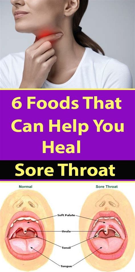6 Foods That Can Help You Heal Sore Throat Foods For Sore Throat Sore Throat Heal Sore Throat